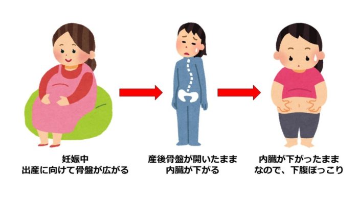 骨盤トラブルの説明